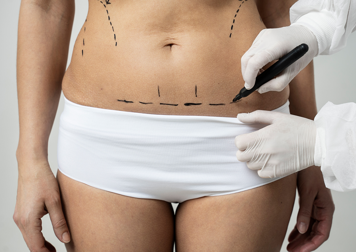 Cirurgia Plástica Reparadora